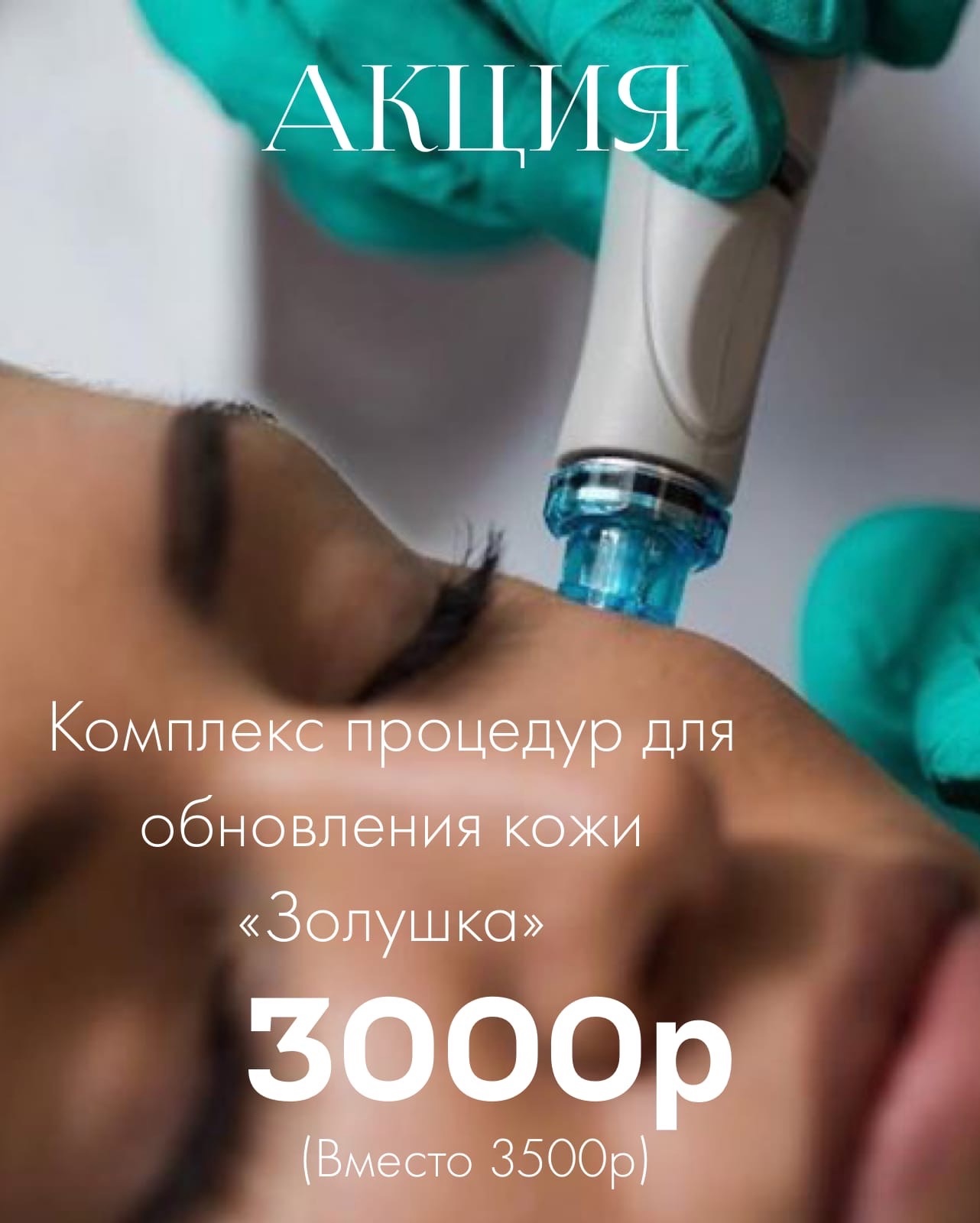 Акция - Комплекс процедур для обновления кожи «Золушка» в Кирове